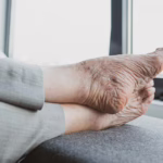 Fin de vie – A quand une loi ?