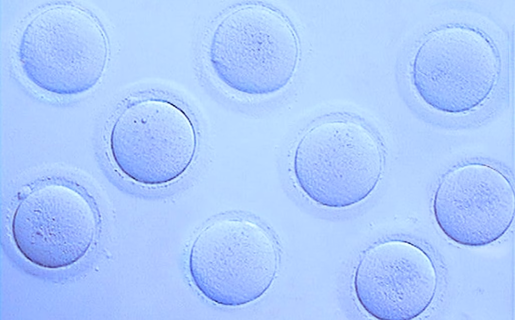 Pourquoi tant de jeunes femmes recourent à la congélation de leurs ovocytes ?