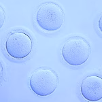 Pourquoi tant de jeunes femmes recourent à la congélation de leurs ovocytes ? 